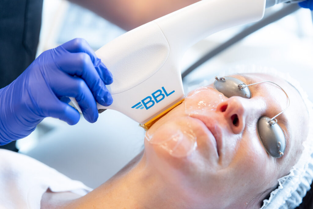 pearlman aesthetic surgery bbl hero 4486